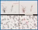 MCID Analysis